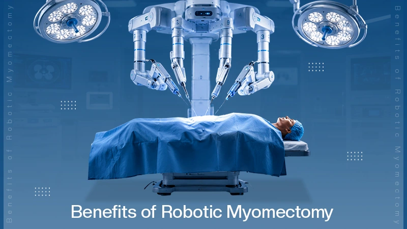 Benefits of Robotic Myomectomy