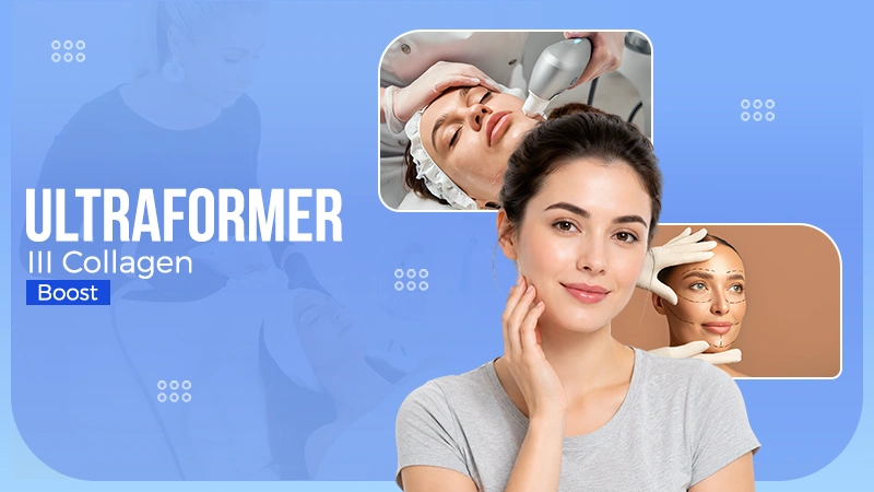 ultraformer iii treatment