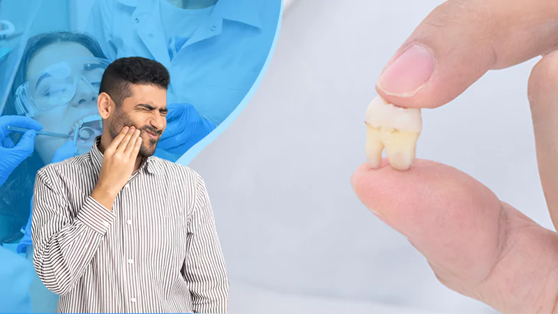 Immediate Steps to Take After You Lost a Tooth (1)