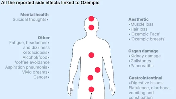 Ozempic side effect