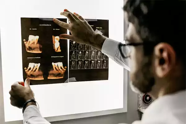 A Doctor Checking Diag Images